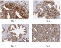 Anti-Epithelial Specific Antigen Antibody, clone VU-1D9 clone VU-1D9, from mouse