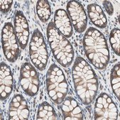 Anti-RAD54B antibody produced in rabbit Prestige Antibodies&#174; Powered by Atlas Antibodies, affinity isolated antibody, buffered aqueous glycerol solution