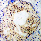 Anti-phospho-Estrogen Receptor-&#945; (pSer118) antibody produced in rabbit affinity isolated antibody
