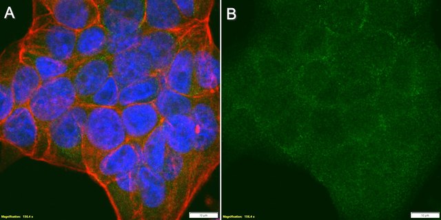 Anti-L1CAM/CD171 Antibody, clone 2B15 ZooMAb&#174; Rabbit Monoclonal recombinant, expressed in HEK 293 cells
