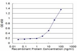 Monoclonal Anti-S100A7 antibody produced in mouse clone 1F8, purified immunoglobulin, buffered aqueous solution
