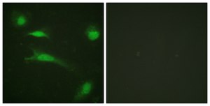 Anti-p53 antibody produced in rabbit affinity isolated antibody