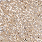 Anti-AGT antibody produced in rabbit Prestige Antibodies&#174; Powered by Atlas Antibodies, affinity isolated antibody, buffered aqueous glycerol solution