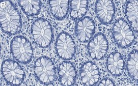 Anti-IQGAP1 Antibody, clone 4M20 ZooMAb&#174; Rabbit Monoclonal recombinant, expressed in HEK 293 cells