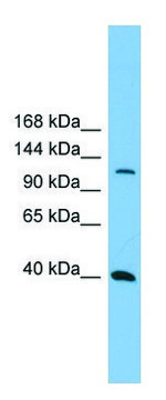 Anti-MAP3K14 (N-terminal) antibody produced in rabbit affinity isolated antibody