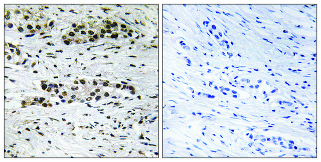 Anti-phospho-Estrogen Receptor-&#945; (pSer102) antibody produced in rabbit affinity isolated antibody
