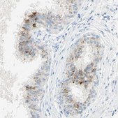 Anti-GDF15 antibody produced in rabbit Prestige Antibodies&#174; Powered by Atlas Antibodies, affinity isolated antibody, buffered aqueous glycerol solution