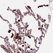 Anti-CES1 antibody produced in rabbit Prestige Antibodies® Powered by Atlas Antibodies, affinity isolated antibody, buffered aqueous glycerol solution