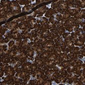 Anti-P4HB antibody produced in rabbit Prestige Antibodies&#174; Powered by Atlas Antibodies, affinity isolated antibody, buffered aqueous glycerol solution