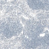Monoclonal Anti-CTGF antibody produced in mouse Prestige Antibodies&#174; Powered by Atlas Antibodies, clone CL5339, purified immunoglobulin, buffered aqueous glycerol solution