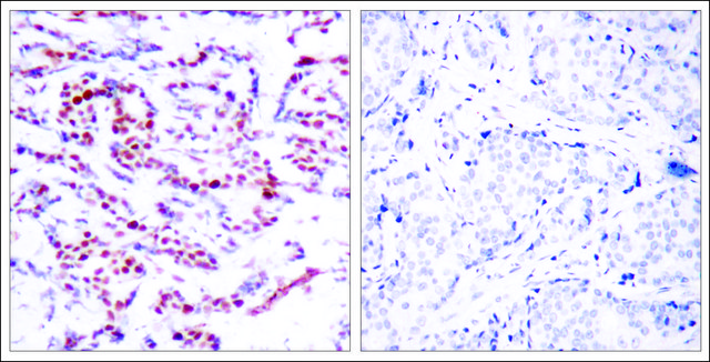 Anti-phospho-ATF2 (pSer112 or pSer94) antibody produced in rabbit affinity isolated antibody