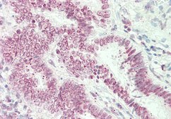 Anti-ST6GALNAC1 antibody produced in rabbit affinity isolated antibody