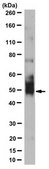 Anti-Transmembrane Prostatic Acid Phosphatase Antibody/TMPAP, clone 3G10.1 clone 3G10.1, from mouse