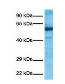 Anti-ZNF306 antibody produced in rabbit affinity isolated antibody
