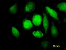 Anti-MAOB antibody produced in mouse purified immunoglobulin, buffered aqueous solution