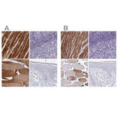 Anti-CASQ2 antibody produced in rabbit Prestige Antibodies&#174; Powered by Atlas Antibodies, affinity isolated antibody, buffered aqueous glycerol solution