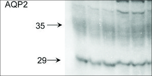 Anti-AQP2 antibody produced in rabbit 1&#160;mg/mL, affinity isolated antibody