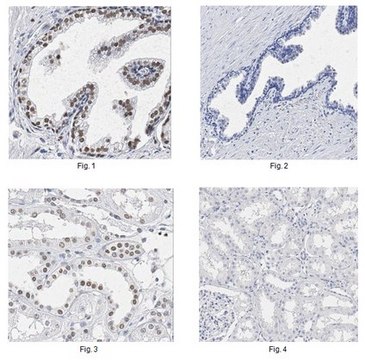 Anti-P40 Antibody, clone 11F12.1 clone 11F12.1, from mouse