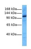 Anti-RNF31 antibody produced in rabbit affinity isolated antibody