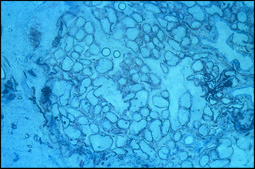 Monoclonal Anti-S-100 (&#946;-Subunit) antibody produced in mouse clone SH-B1, ascites fluid