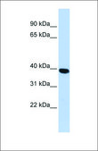 Anti-HYAL1 (ab2) antibody produced in rabbit affinity isolated antibody
