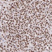 Anti-SOX6 antibody produced in rabbit Prestige Antibodies&#174; Powered by Atlas Antibodies, affinity isolated antibody, buffered aqueous glycerol solution