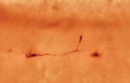 Anti-Reelin Antibody, a.a. 164-189 mreelin, clone 142 clone 142, Chemicon&#174;, from mouse