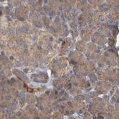 Anti-TSPOAP1 antibody produced in rabbit Prestige Antibodies® Powered by Atlas Antibodies, affinity isolated antibody, buffered aqueous glycerol solution, Ab2