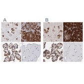 Anti-SND1 antibody produced in rabbit Prestige Antibodies&#174; Powered by Atlas Antibodies, affinity isolated antibody, buffered aqueous glycerol solution