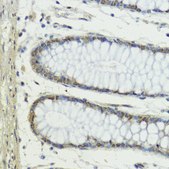 Anti-SNAIL antibody produced in rabbit