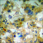Anti-phospho-SEK1/MKK4/JNKK1 (pSer257) antibody produced in rabbit affinity isolated antibody