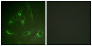 Anti-CSFR antibody produced in rabbit affinity isolated antibody