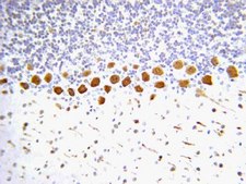 Anti-Nitrotyrosine Antibody Chemicon&#174;, from rabbit