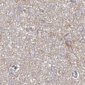 Anti-ASCC3 antibody produced in rabbit Prestige Antibodies® Powered by Atlas Antibodies, affinity isolated antibody, buffered aqueous glycerol solution, ab1