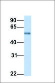 Anti-PPAT antibody produced in rabbit affinity isolated antibody