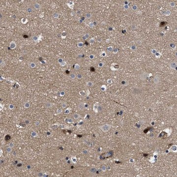 Anti-SPAST antibody produced in rabbit Prestige Antibodies&#174; Powered by Atlas Antibodies, affinity isolated antibody, buffered aqueous glycerol solution