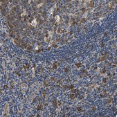 Anti-PPP2R1B antibody produced in rabbit Prestige Antibodies&#174; Powered by Atlas Antibodies, affinity isolated antibody, buffered aqueous glycerol solution