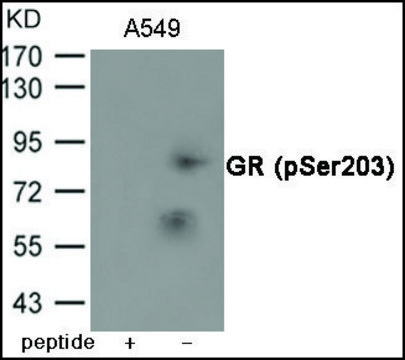 Anti-phospho-GR (pSer203) antibody produced in rabbit affinity isolated antibody