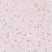 Anti-SLC18A2 antibody produced in mouse Prestige Antibodies&#174; Powered by Atlas Antibodies, clone CL13157, purified by using Protein A, buffered aqueous glycerol solution