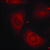 Anti-phospho-LIMK2 (pThr505) antibody produced in rabbit affinity isolated antibody