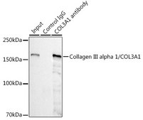Anti-Collagen III alpha 1/COL3A1 Antibody, clone 6Y9C6, Rabbit Monoclonal