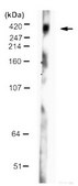 Anti-Huntingtin Antibody, a.a. 1-82 ascites fluid, clone 2B4, Chemicon&#174;