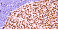 Anti-ARF1 Antibody, clone 3F1 clone 3F1, from mouse