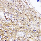 Anti-COL1A1 antibody produced in rabbit