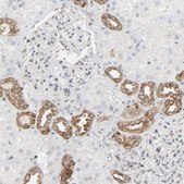Anti-MUC1 antibody produced in rabbit Prestige Antibodies&#174; Powered by Atlas Antibodies, affinity isolated antibody, buffered aqueous glycerol solution