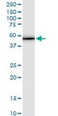 Monoclonal Anti-TMOD3, (C-terminal) antibody produced in mouse clone 1E1, purified immunoglobulin, buffered aqueous solution