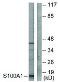 Anti-S100 A1, N-Terminal antibody produced in rabbit affinity isolated antibody