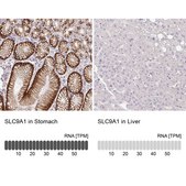 Anti-SLC9A1 antibody produced in rabbit Prestige Antibodies® Powered by Atlas Antibodies, affinity isolated antibody, buffered aqueous glycerol solution