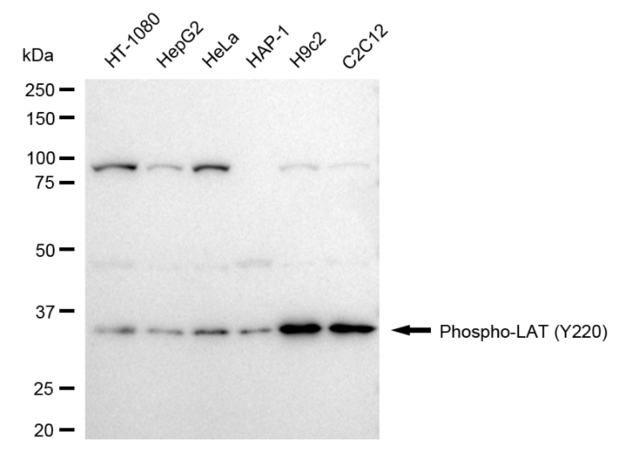 Anti-phospho-LAT (Tyr220) Antibody, clone 24GB1375, Rabbit Monoclonal clone 24GB1375, recombinant rabbit monoclonal, expressed in HEK293 cells