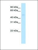 Anti-PIAS2 (AB1) antibody produced in rabbit affinity isolated antibody